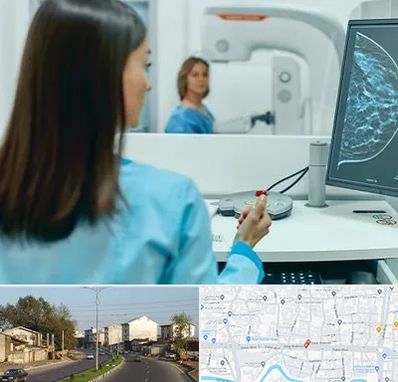 ماموگرافی در ضیابری رشت