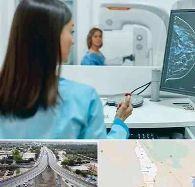 ماموگرافی در اندیمشک