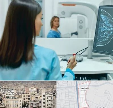 ماموگرافی در اسکندری