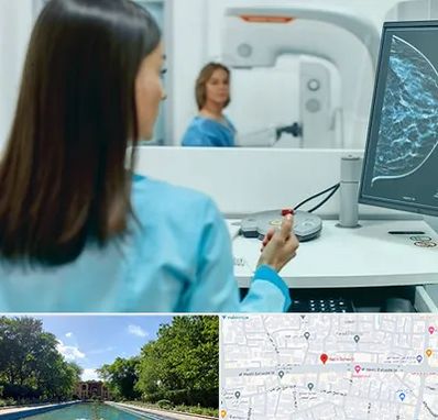 ماموگرافی در هشت بهشت اصفهان