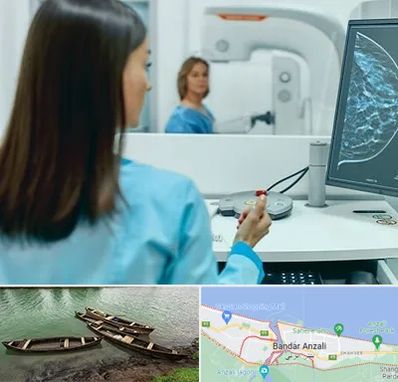 ماموگرافی در بندر انزلی