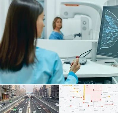 ماموگرافی در توحید