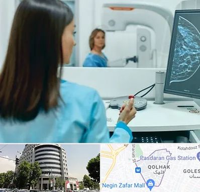 ماموگرافی در قلهک 