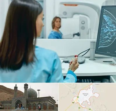 ماموگرافی در شهرضا