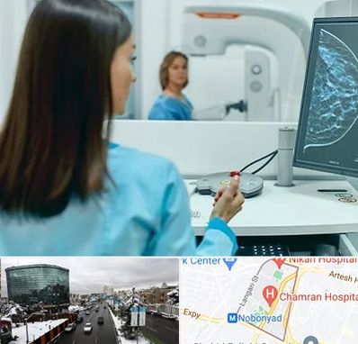 ماموگرافی در اقدسیه 