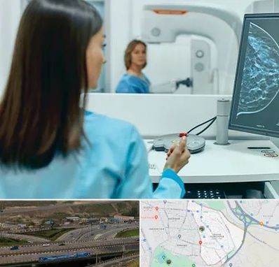 ماموگرافی در یاغچیان تبریز