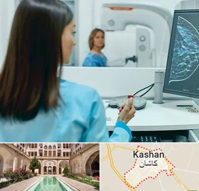 ماموگرافی در کاشان