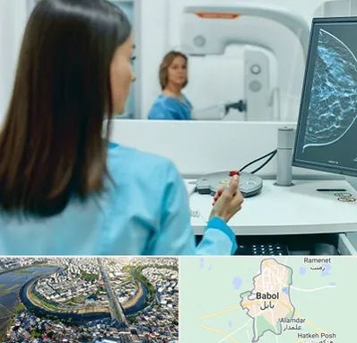 ماموگرافی در بابل