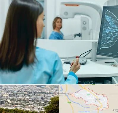 ماموگرافی در یاسوج