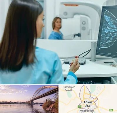 ماموگرافی در اهواز