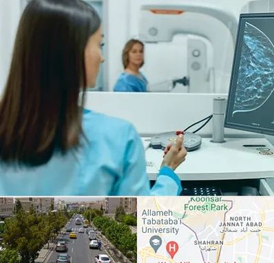 ماموگرافی در شهران 