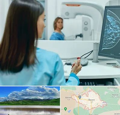 ماموگرافی در مرند