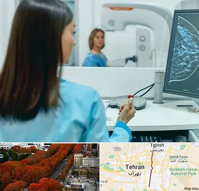 ماموگرافی در ولیعصر 