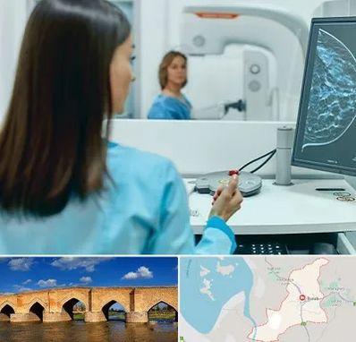 ماموگرافی در بناب