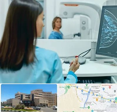 ماموگرافی در صیاد شیرازی مشهد