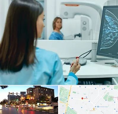 ماموگرافی در بلوار سجاد مشهد