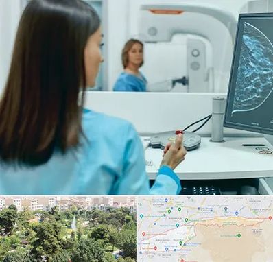 ماموگرافی در منطقه 13 تهران