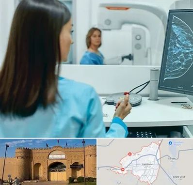 ماموگرافی در ایرانشهر