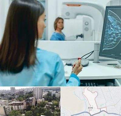 ماموگرافی در اوین