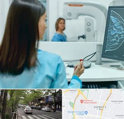 ماموگرافی در ظفر 