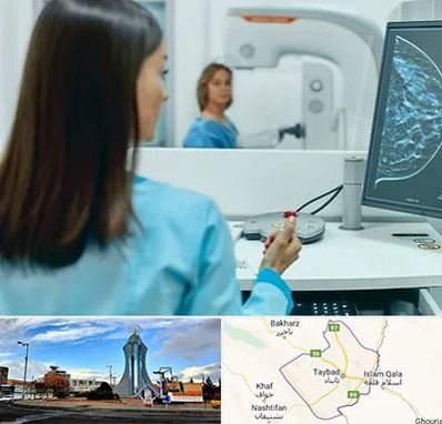 ماموگرافی در تایباد