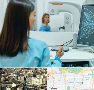 ماموگرافی در مرزداران 