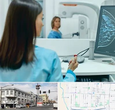 ماموگرافی در 17شهریور