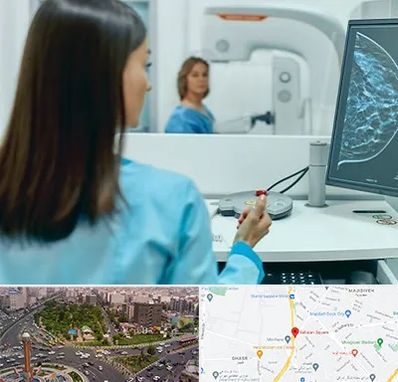 ماموگرافی در سبلان