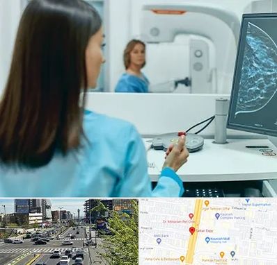 ماموگرافی در ستاری