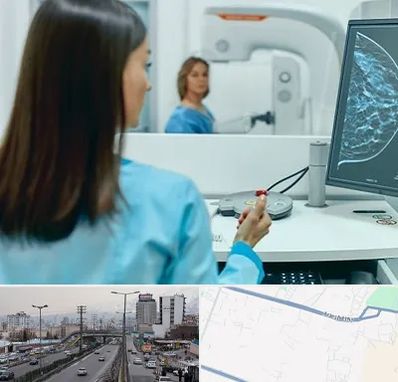 ماموگرافی در بلوار ارتش