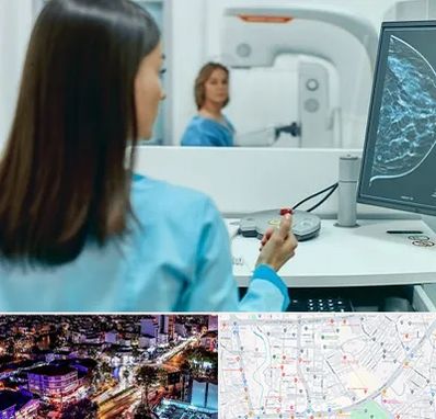 ماموگرافی در منظریه رشت