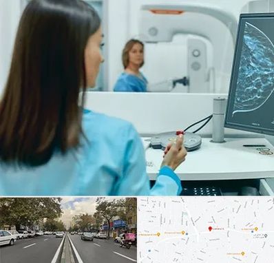 ماموگرافی در دولت