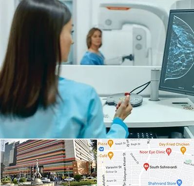 ماموگرافی در سهروردی 