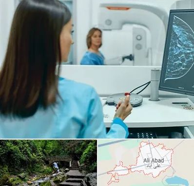 ماموگرافی در علی آباد کتول