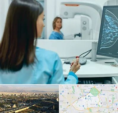 ماموگرافی در منطقه 19 تهران