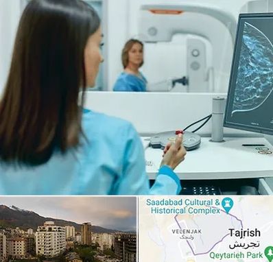 ماموگرافی در زعفرانیه 