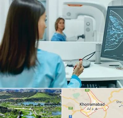 ماموگرافی در خرم آباد