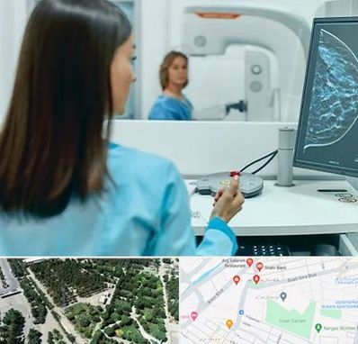 ماموگرافی در سالاریه قم