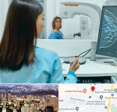 ماموگرافی در جردن 