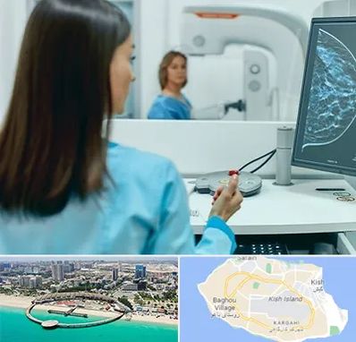 ماموگرافی در کیش