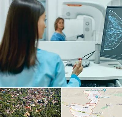 ماموگرافی در دماوند