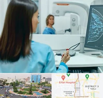 ماموگرافی در ونک 