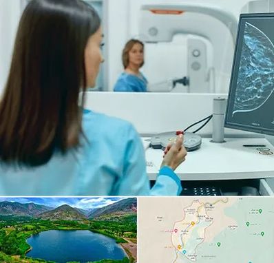 ماموگرافی در رودبار