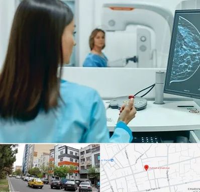 ماموگرافی در هفده شهریور تبریز