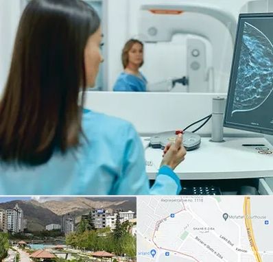 ماموگرافی در شهر زیبا