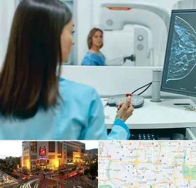 ماموگرافی در جنت آباد تهران 