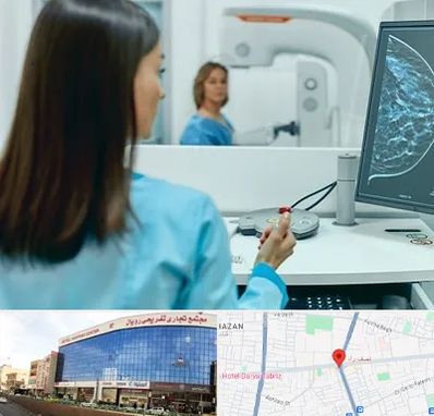 ماموگرافی در نصف راه تبریز