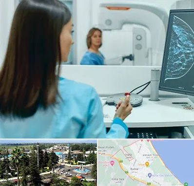 ماموگرافی در رودسر