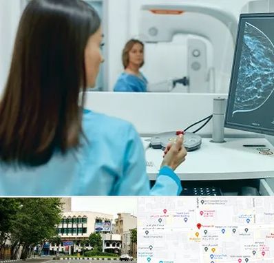 ماموگرافی در طالقانی