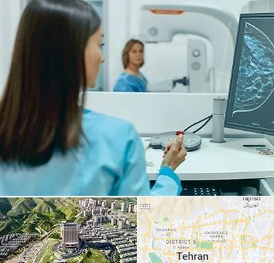 ماموگرافی در شمال تهران 